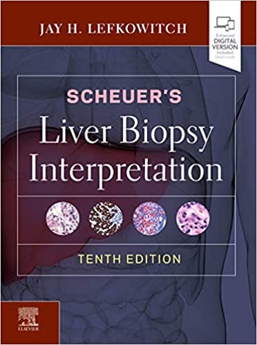 Scheuer's Liver Biopsy Interpretation 10th Edition 2020 by Jay H. Lefkowitch