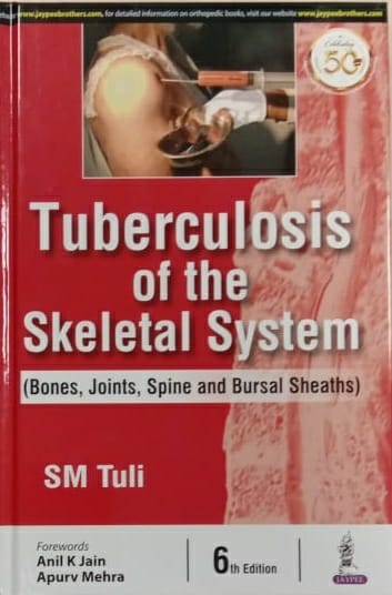 Tuberculosis of the Skeletal System 6th Edition 2020 by SM Tuli