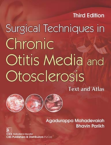 Surgical Techniques in Chronic Otitis Media and Otosclerosis: Text and Atlas 3rd Edition 2020 by A. Mahadevaiah