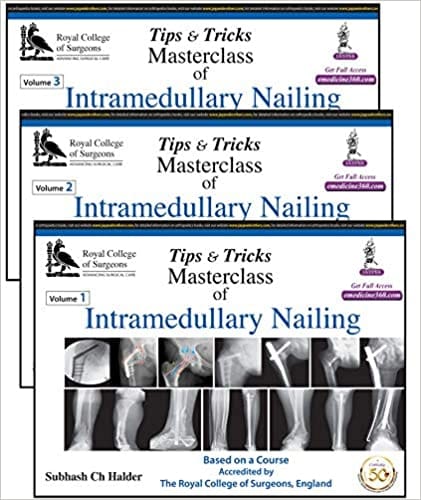 Tips and Tricks Masterclass of Intramedullary Nailing (3 Volume Set) 1st Edition 2020 by Halder Subash