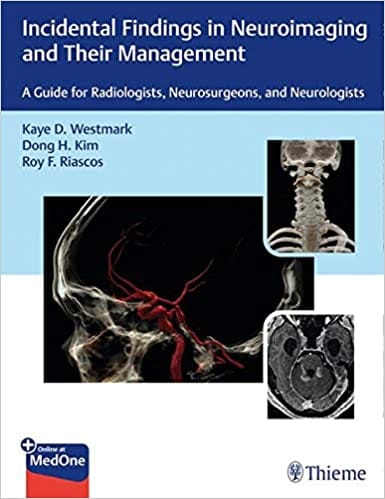 Incidental Findings in Neuroimaging and Their Management 1st Edition 2020 by Westmark