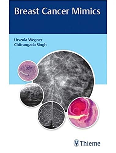 Breast Cancer Mimics 1st Edition 2020 by Urszula Wegner