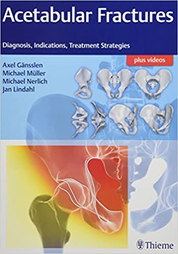 Acetabular Fractures: Diagnosis, Indications, Treatment Strategies 1st Edition 2017 by Axel Gansslen