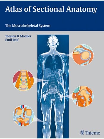 Atlas of Sectional Anatomy 1st Edition 2010 by Moeller , Reif