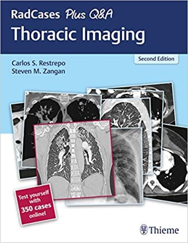 RadCases Plus Q&A Thoracic Imaging 2nd Edition 2018 by Restrepo