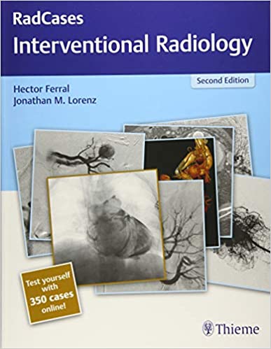 Radcases Interventional Radiology 2nd Edition 2018 by Ferral