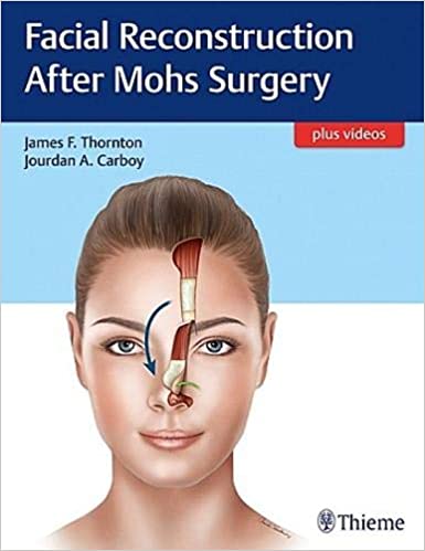 Facial Reconstruction After Mohs Surgery 1st Edition 2018 by Thornton
