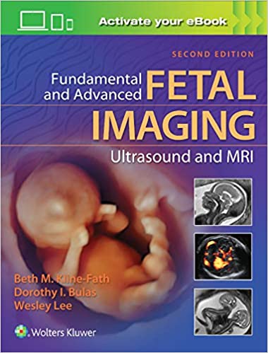 Fundamental and Advanced Fetal Imaging Ultrasound and MRI 2nd Edition 2021 by Beth Kline-Fath