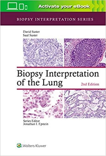 Biopsy Interpretation of The Lung 2nd Edition 2021 by Saul Suster