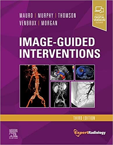 Image Guided Interventions 3rd Edition 2021 by Mauro M.A.