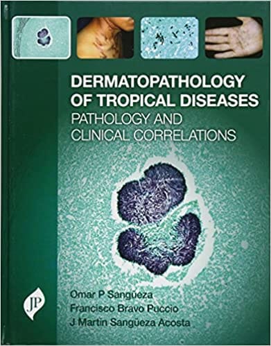 Dermatopathology of Tropical Diseases 1st Edition 2017 by Sangueza Omar