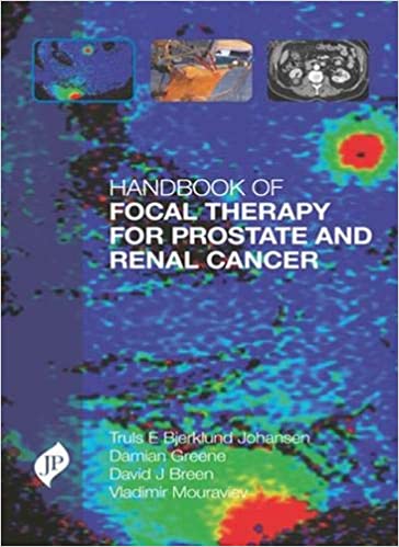 Handbook of Focal Therapy for Prostate and Renal Cancer 1st Edition 2017 by Truls Bjerklund Johansen