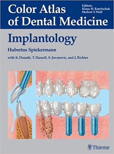 Implantology: Color Atlas of Dental Medicine By Hurbertus Spiekermann