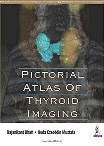 Pictorial Atlas Of Thyroid Imaging 2016 by Rajanikant Bhatt
