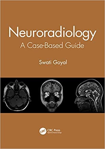 Neuroradiology: A Case-Based Guide 2021 By Swati Goyal