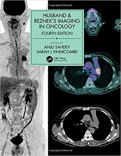 Husband & Reznek's Imaging in Oncology 4th Edition 2020 by Anju Sahdev