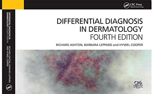 Differential Diagnosis in Dermatology 4th Edition 2014 By Richard Ashton