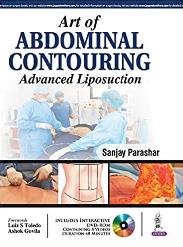Art Of Abdominal Contouring Advanced Liposuction With Dvd-Rom 1st Edition 206 by Sanjay Parashar