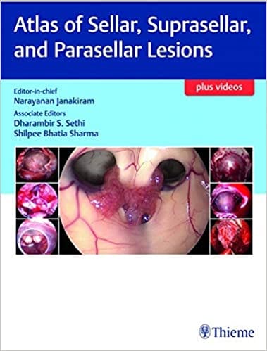 Atlas of Sellar, Suprasellar and Parasellar Lesions 1st Edition 2019 by Janakiram