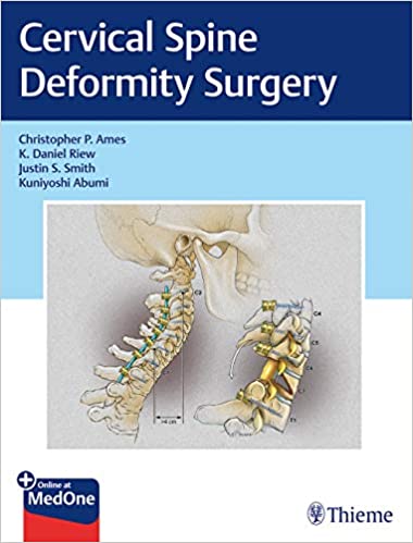 Cervical Spine Deformity Surgery 1st Edition 2019 by Christopher Ames