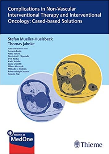 Complications in Non-vascular Interventional Therapy and Interventional Oncology 1st Edition 2019 by Stefan M?ller-H?lsbeck