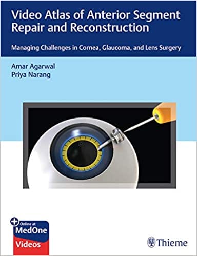 Video Atlas of Anterior Segment Repair and Reconstruction 1st Edition 2019 by Amar Agarwal