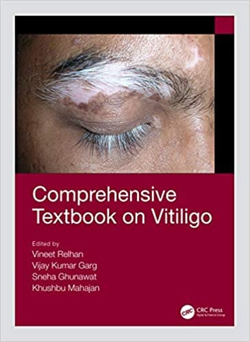 Comprehensive Textbook on Vitiligo 2020 by Vineet Relhan