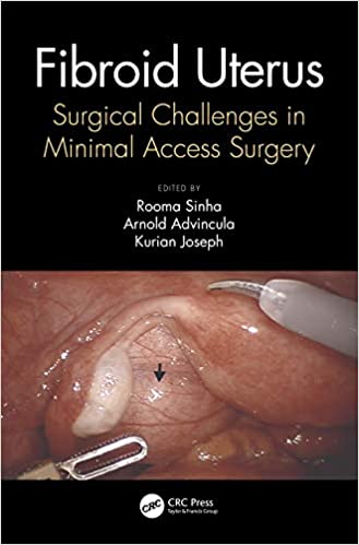 Fibroid Uterus: Surgical Challenges in Minimal Access Surgery 2020 by Rooma Sinha