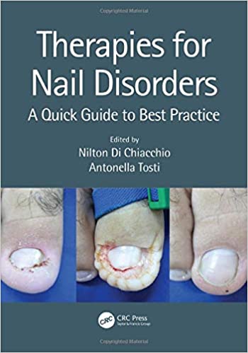 Therapies for Nail Disorders: A Quick Guide to Best Practice 2020 by Nilton Di Chiacchio