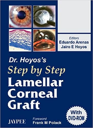 Dr.Hoyos' Step By Step Lamellar Corneal Graft With Dvd-Rom 2006 by Arenas