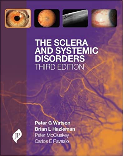 The Sclera And Systemic Disorders 2012 by Watson