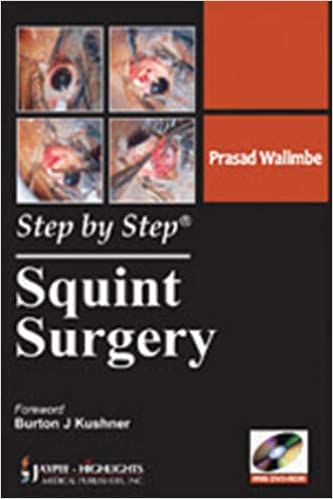 Step By Step Squint Surgery 2011 by Walimbe