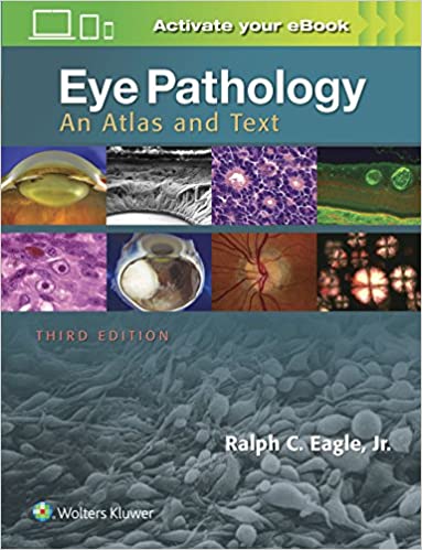 Eye Pathology An Atlas and Text 3rd Edition 2017 by Ralph C. Eagle