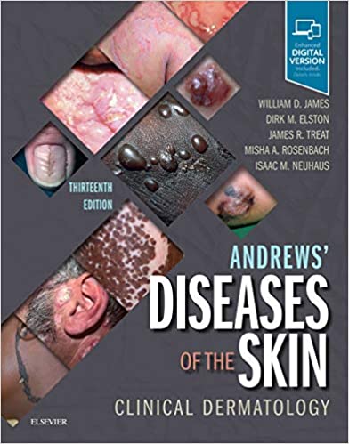 Andrews' Diseases of the Skin: Clinical Dermatology 13th Edition 2020 by William D. James