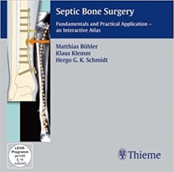 Septic Bone Surgery CD-ROM by Matthias Buehler