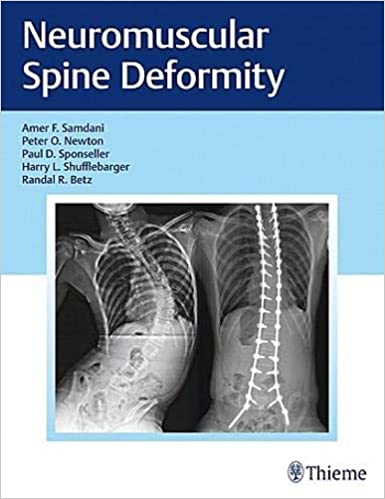 Neuromuscular Spine Deformity 2018 by Samdani