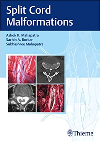 Split Cord Malformations 1st Edition 2021 by Mahapatra