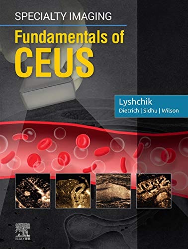 Specialty Imaging: Fundamentals of CEUS 1st Edition 2019 by Andrej Lyshchik