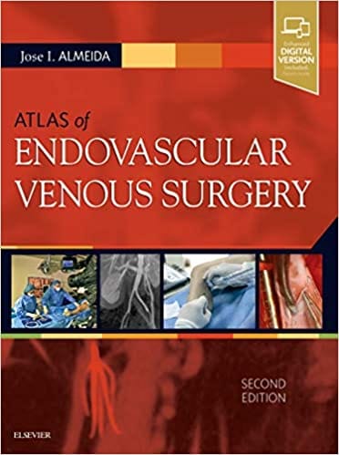 Atlas of Endovascular Venous Surgery 2nd Edition 2018 By Jose Almeida