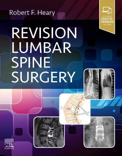 Revision Lumbar Spine Surgery 1st edition 2021 by Heary