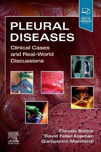 Pleural Diseases 1st edition 2021 by Sorino