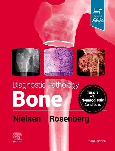 Diagnostic Pathology: Bone 3rd edition 2021 by Nielsen