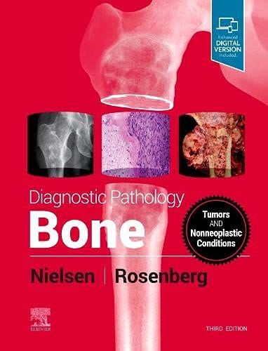 Diagnostic Pathology: Bone 3rd edition 2021 by Nielsen
