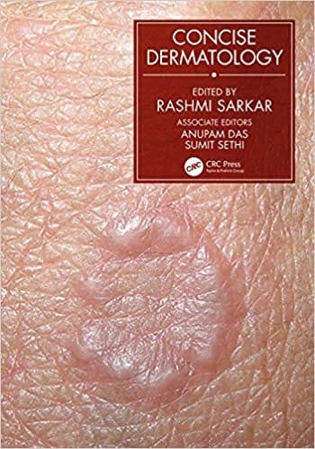 Concise Dermatology 2021 By Rashmi Sarkar
