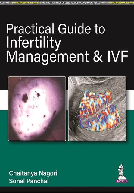 Practical Guide to Infertility Management & IVF 1st Edition 2022 By Chaitanya Nagori & Sonal Panchal