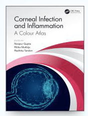 Corneal Infection and Inflammation A Colour Atlas 2021 by Nupoor Gupta