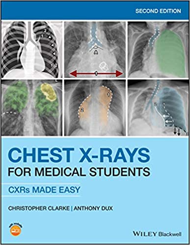 Chest X-Rays for Medical Students (CXRs Made Easy) 2nd Edition 2020 By Christopher Clarke
