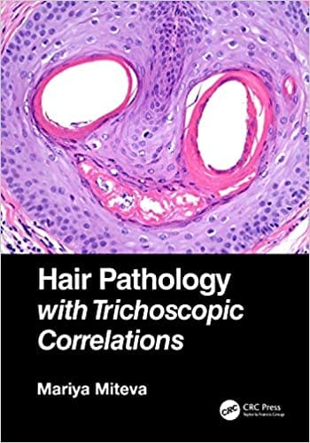Hair Pathology with Trichoscopic Correlations 2022 by Mariya Miteva