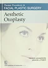 Aesthetic Otoplasty (Thomas Procedures In Facial Plastic Surgery)-Sie  By Adamson P.
