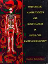 Orthopaedic Manifestations And Bone Changes In Sickle Cell Haemoglobinopathy (1997) By Babhulkar S.